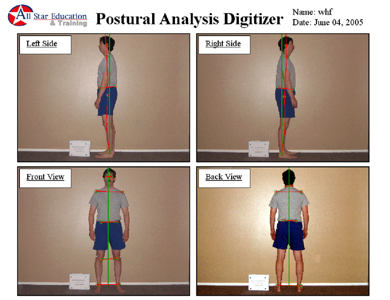 Posture Analysis